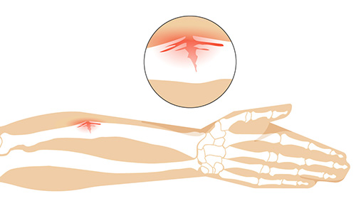 Magnetoterapia Meda